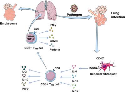 The Roles of Tissue-Resident Memory T Cells in Lung Diseases